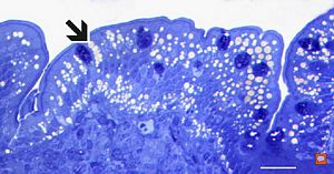  lipid malabsorption - large lipid droplets in enterocytes … semithin section